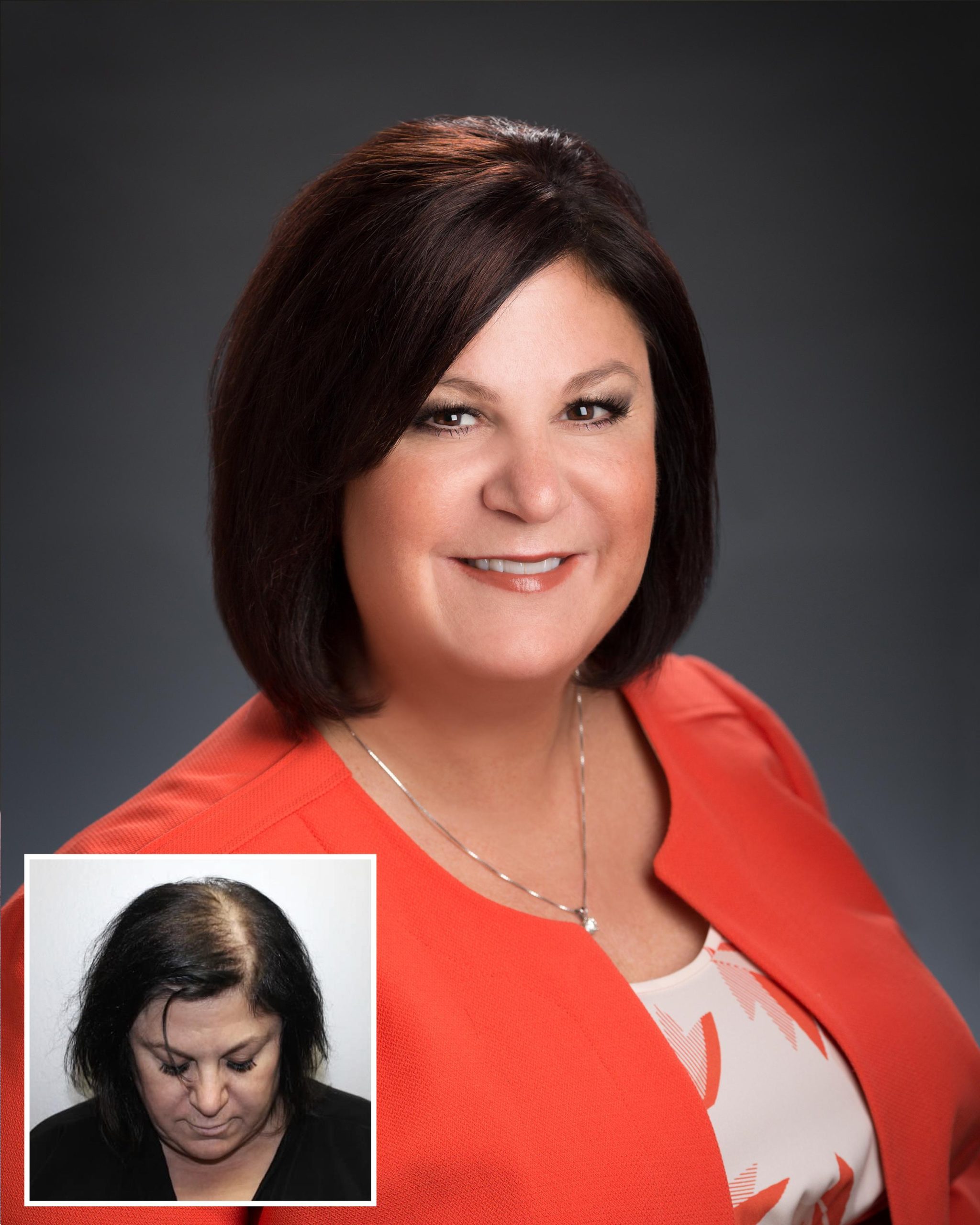 242088_1531BeforeAfter_300