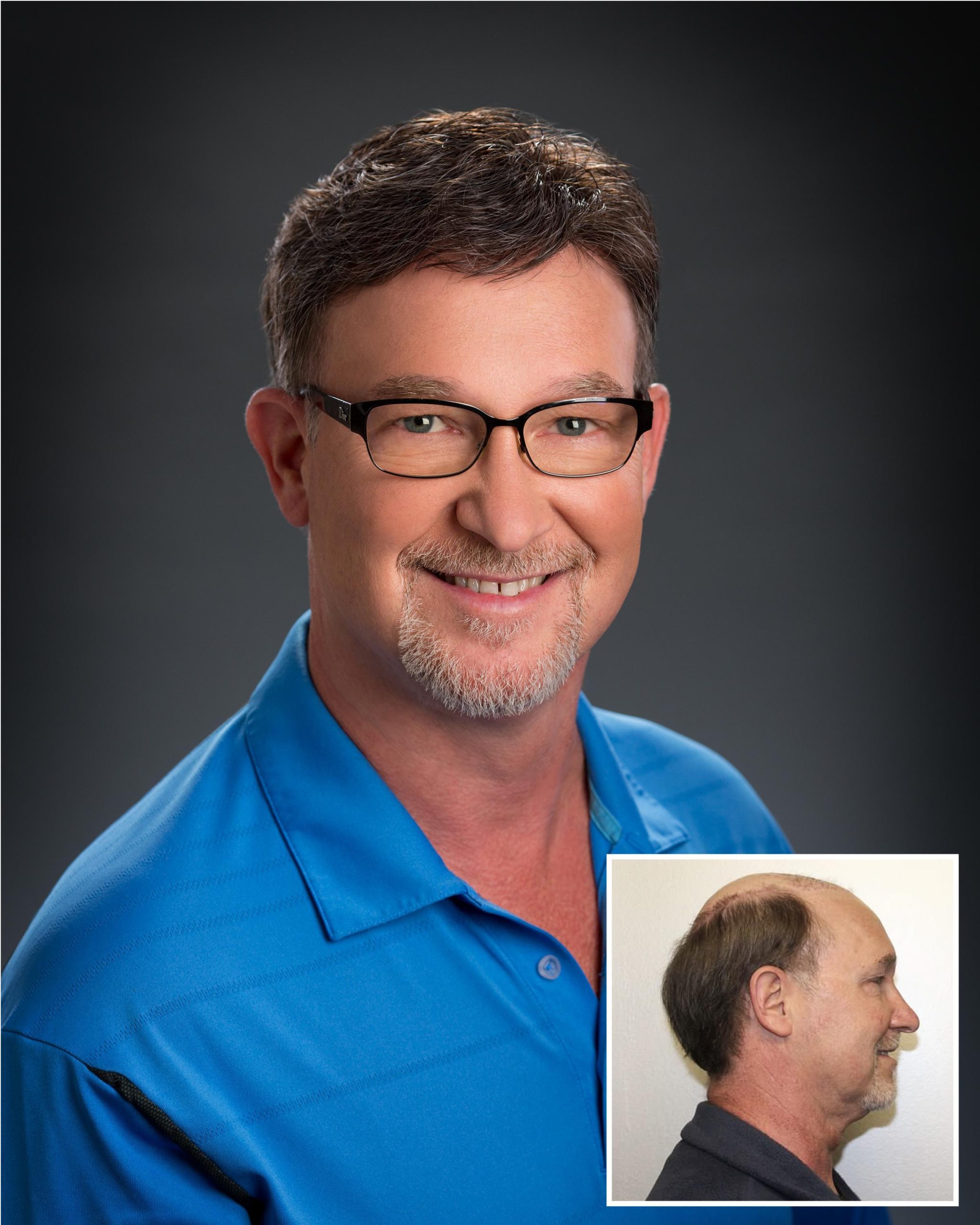 242088_1543BeforeAfter_300