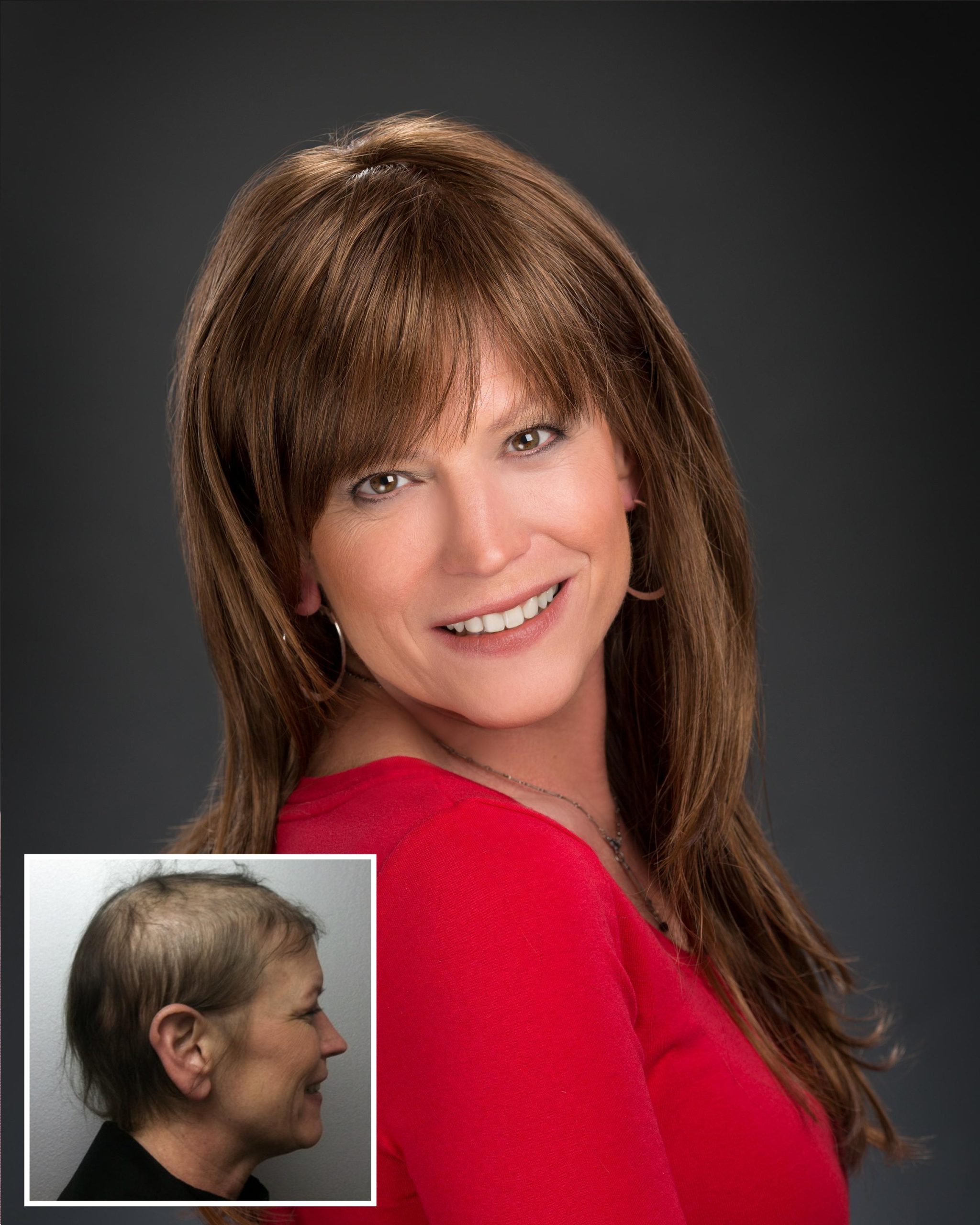 242088_1596BBeforeAfter_300